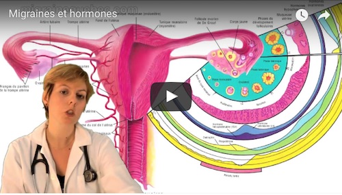 Migraines et hormones